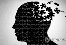 알츠하이머병 감별하는 혈액 단백질 찾았다…"진단 활용 기대"