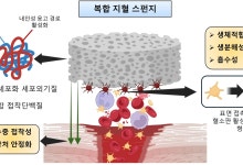 "수술때 지혈문제 해법 찾았다"…홍합 단백질로 지혈스펀지 개발