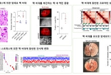 "정상보다 큰 암세포의 핵, 악화 신호 아닌 억제 가능성"