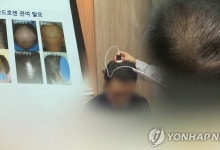 지난해 병원 찾은 탈모 환자 10명 중 4명 20∼30대
