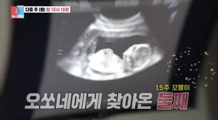 오상진<b>김소영</b>, 둘째 임신…축복 속 부부싸움 왜?