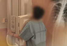 “간접흡연·음식 조리·대기오염 영향”…폐암 수술 14년 새 3배↑