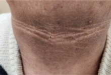 "우리 애 겨드랑이에 때가 꼈나?"…갑자기 검게 변했다면 '이 병' 의심해 봐야