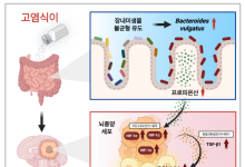 KAIST “짠 음식 많이 먹으면 뇌종양 악화”