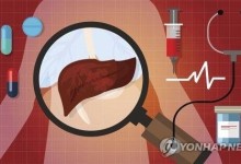 "술도 안마시는데 간암이라고?"..소리없는 간암, 조기진단이 관건 [weekend 헬스]