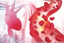 고혈압·당뇨만큼 무서운 이 병…'때이른 죽음' 80% 막으려면