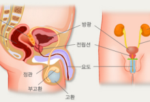 여름철 위협받는 남성만의 ‘이곳’··· 건강하게 관리하려면