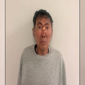 인천 흉기난동범 최충락 사이코패스 검사 검토…마약 성분은 불검출