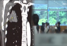 과도한 ‘병원 순례’, 폐암 환자 사망 위험 높인다