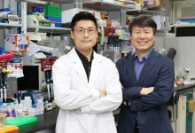 항우울제, 노인에 효과없는 이유는?…노화된 뇌 '넘비 단백질' 과발현이 원인