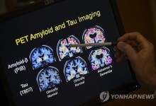 피검사로 알츠하이머 진단한다…FDA 첫 승인