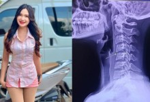 마사지 3번 받고 몸 마비, 사망한 태국 가수...'목 비틀기' 문제였나?