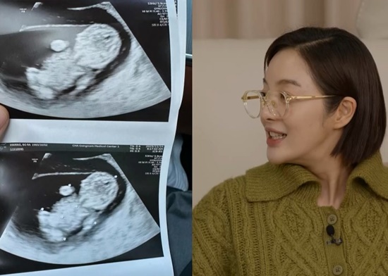 '예비맘' 황보라, <b>강수지</b>김국진 <b>2세</b> 예상 폭탄 발언 "두 분이 설마…" (<b>조선</b>...