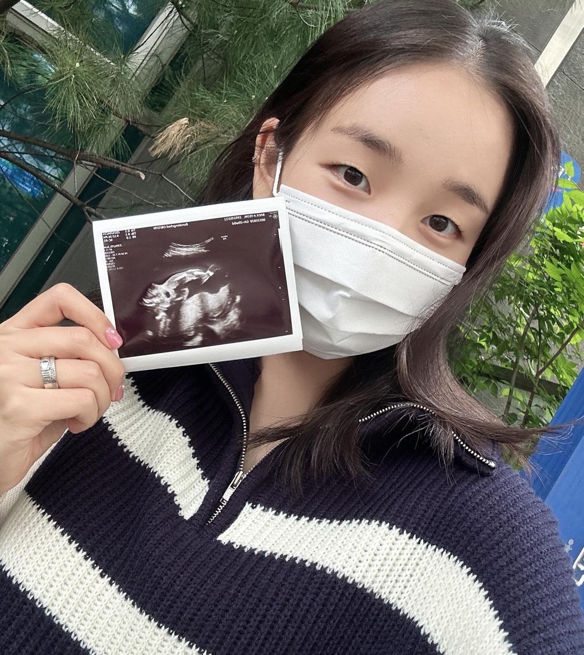 <b>백아연</b>, <b>결혼</b> 8개월만 임신 고백…'용띠맘' 합류 "성별은 딸" [전문]