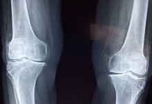 쓰면 쓸수록 더 단단해진다…‘뼈’ 닮은 신소재 개발