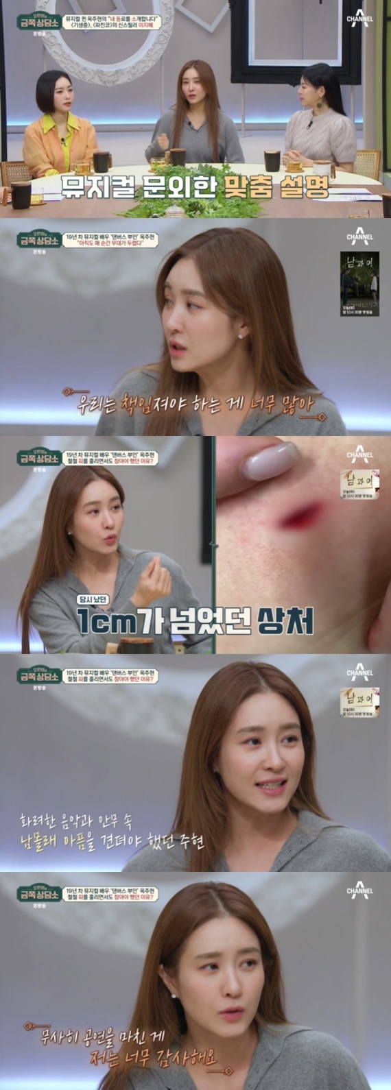 <b>옥주현</b> "피 흘리며 공연…뼈 부러지지 않아 감사했다" 고백