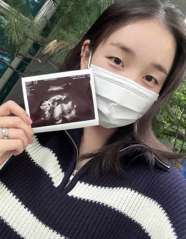 <b>백아연</b>, 엄마된다…"<b>임신 5개월</b>, 성별은 딸"