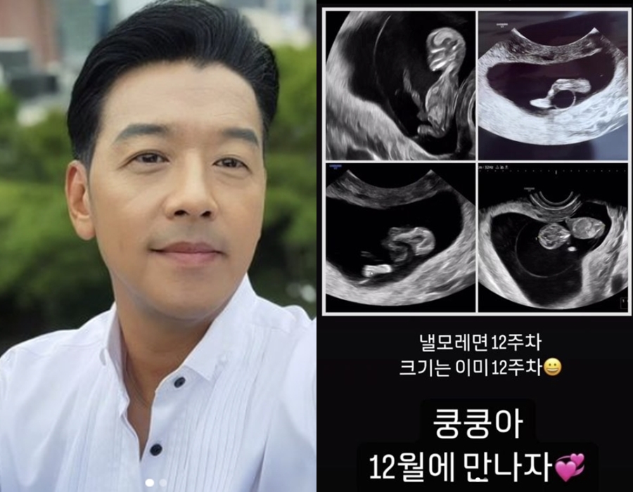 Ryu SiWon to Become a Father Again! Heartwarming Ultrasound Photo