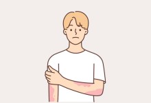 대상포진 백신, 치매 위험 낮춘다…미접종자보다 20% 낮아